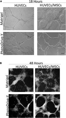 A Substrate-Mimicking Basement Membrane Drives the Organization of Human Mesenchymal Stromal Cells and Endothelial Cells Into Perivascular Niche-Like Structures